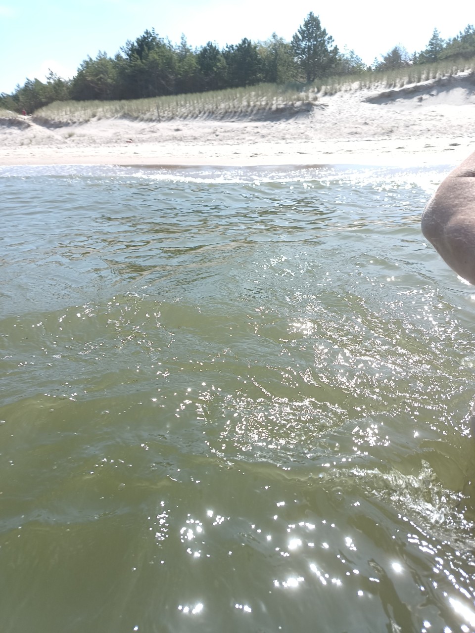 Mimo obijanych kamieniami nóg udało się zrobić zdjęcie
